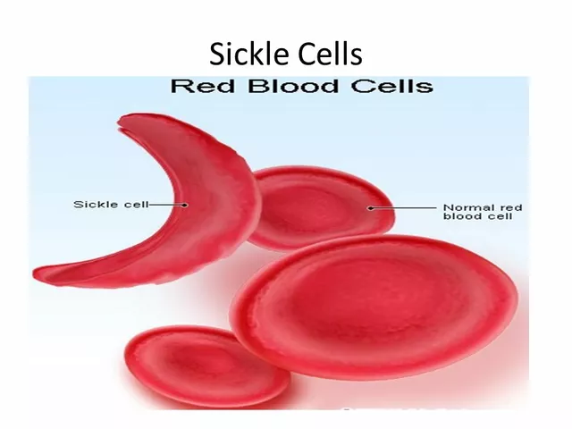 Coping with Grief and Loss in the Sickle Cell Anemia Community